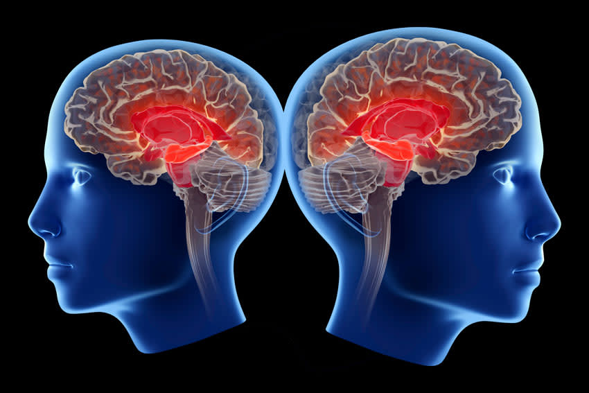 Ilustración de cómo la enfermedad de Alzheimer afecta al hipocampo