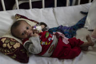 A baby boy lies on a bed as he undergoes treatment at the malnutrition ward of the Ataturk National Children's Hospital in Kabul, Afghanistan, Thursday, Dec, 2, 2021. According to U.N. figures from early November, almost 24 million people in Afghanistan, around 60% percent of the population, suffer from acute hunger, including 8.7 million living in near famine. (AP Photo/Petros Giannakouris)