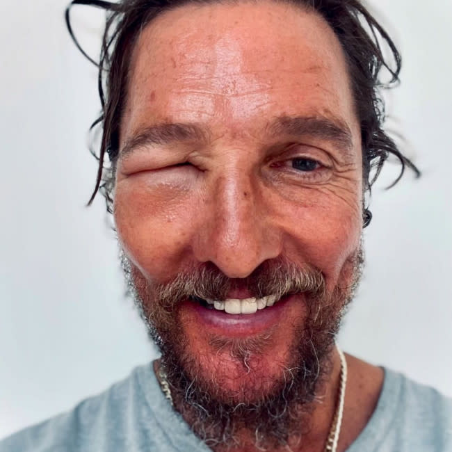 El actor de 'True Detective', de 54 años, mostró el impacto del ataque con una imagen en Instagram en la que aparecía sonriendo a pesar de que su ojo derecho estaba tan hinchado e inflamado que se había cerrado por completo. credit:Bang Showbiz