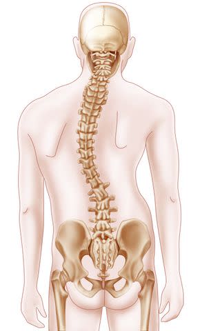 <p>BSIP / UIG / Universal Images Group</p> Diagram of a levoscoliosis.