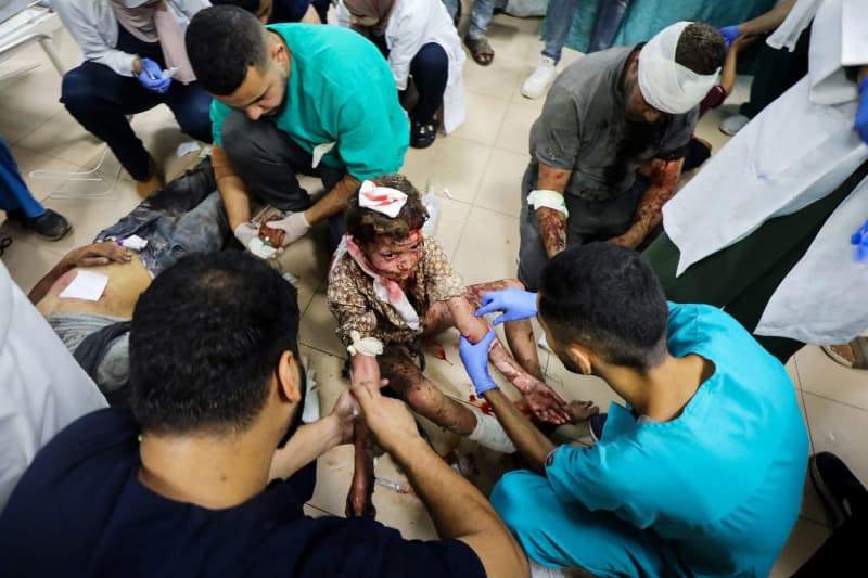 Injured Palestinians receive medical treatment at al Aqsa Martyrs hospital after an Israeli strike hit a school housing displaced people in Deir al-Balah Omar Ashtawy/APA Images via ZUMA Press Wire/dpa