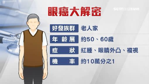 眼癌好發族群約在50、60歲，醫師也強調「機率並不高」。