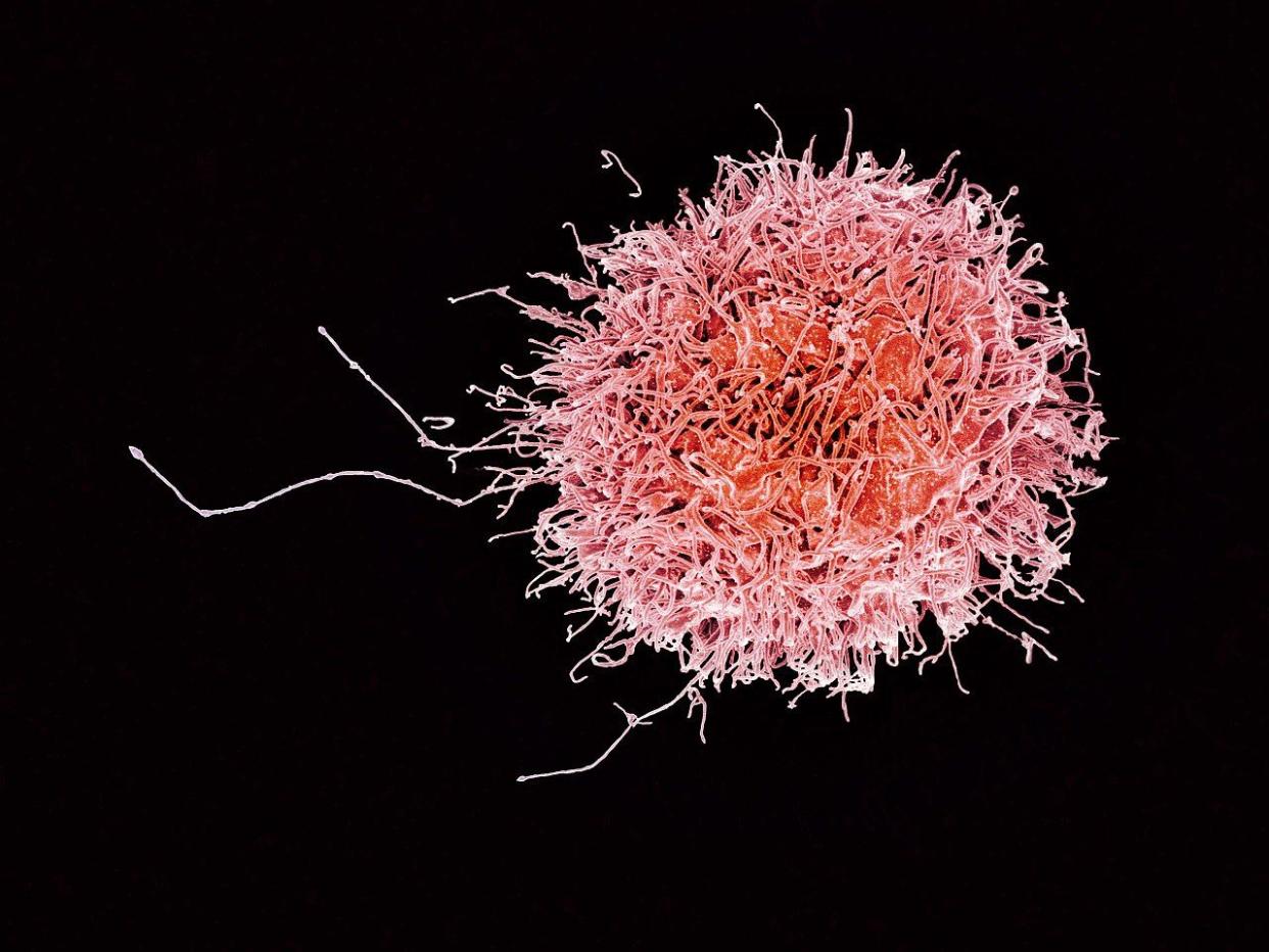 IMAGEN Célula NK humana (coloreada) vista mediante micrografía electrónica de barrido | imagen NIAID CC