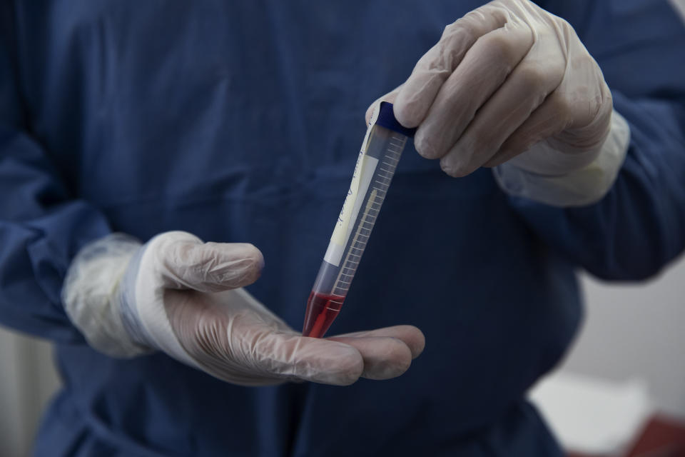 Dr. Victor Garrido holds a tube containing a swab to be tested for COVID-19 at the Ajusco Medio General Hospital in Mexico City, Thursday, Nov. 19, 2020. (AP Photo/Marco Ugarte)