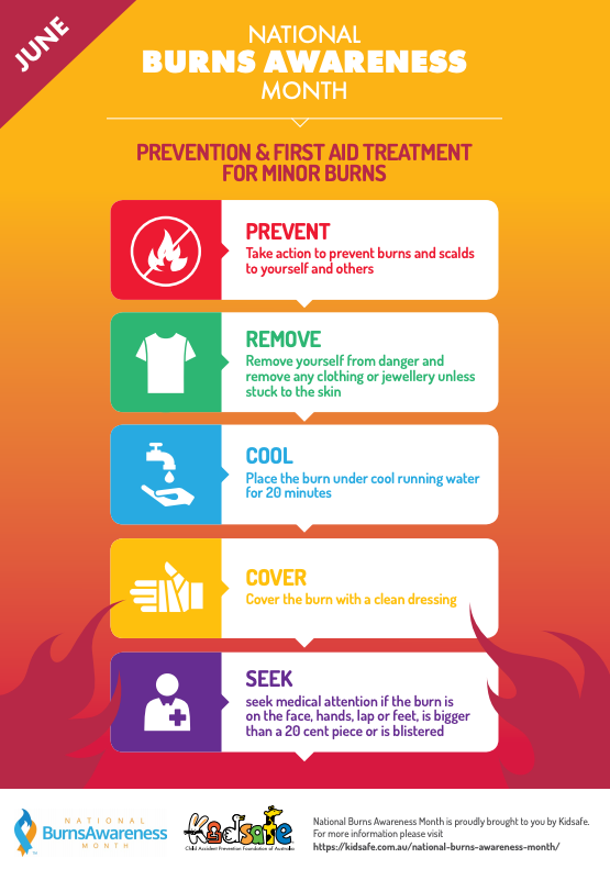 Kidsafe burns prevention and first aid. Photo: Kidsafe.