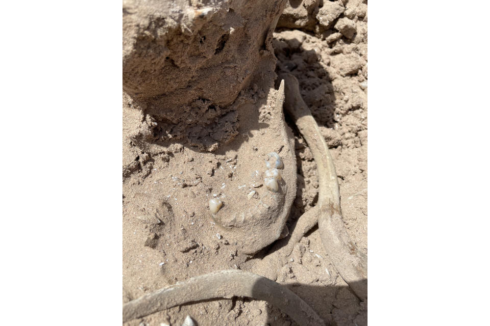 This photo of Saturday, May 7, 2022, provided by Lindsey Melvin of Henderson, Nev., shows human remains she and her sister discovered on a sandbar that recently surfaced as Lake Mead recedes. A closer look revealed a human jaw with teeth. The National Park Service confirmed in a statement that the remains are human. (Lindsey Melvin via AP)