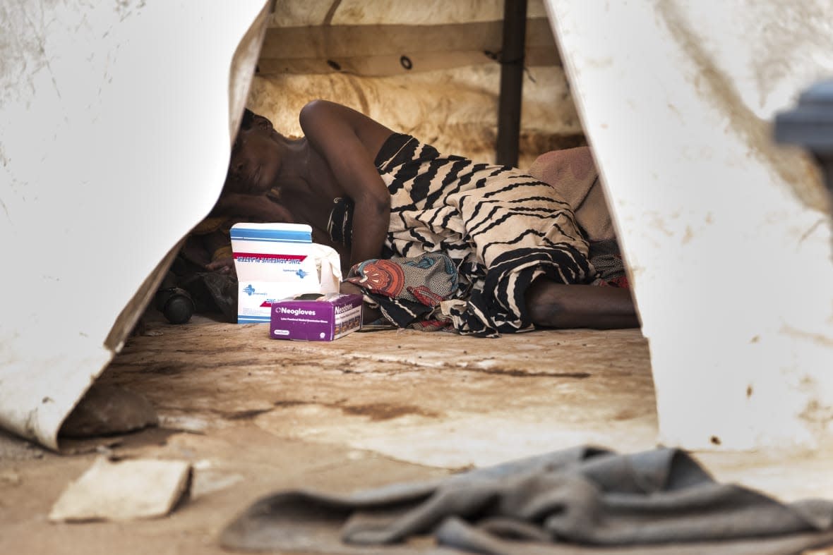 A cholera patient is seen inside an isolation ward at the Bwaila Hospital in Lilongwe central Malawi Wednesday, Jan. 11, 2023. Malawi’s health minister says the country’s worst cholera outbreak in two decades has killed 750 people so far. The southern African country of 20 million people first reported the outbreak in March last year. (AP Photo/Thoko Chikondi)