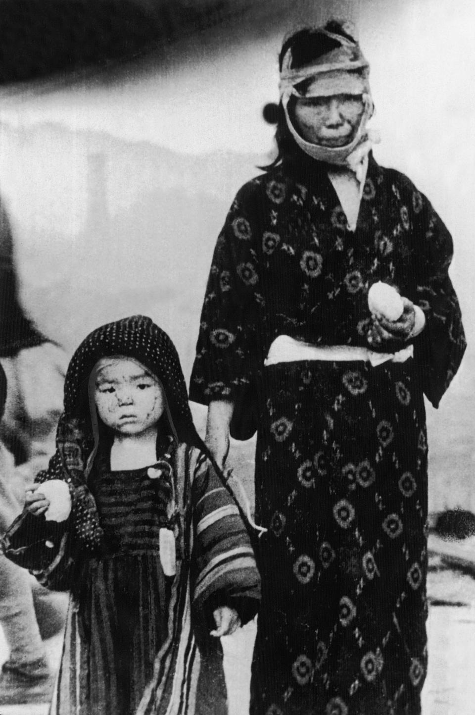 A Japanese woman is seen with a child in traditional Japanese clothing, who survived the atomic bomb dropped on Nagasaki, in Nagasaki, Japan, in this Aug. 9, 1945 file photo. Their faces are marked with burns by the heat of the explosion. Scanty food rations are given out to the suffering public. 