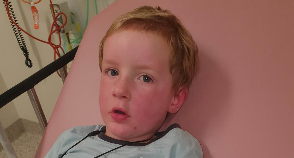 Owen in hospital with a red face after he had his first anaphylaxis scare when he was three after eating a home-made wonton. Source: Supplied. 