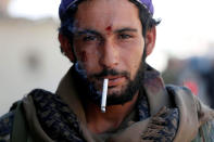 <p>A member of Syrian Democratic Forces who was wounded during a battle with Islamic State militants smokes a cigarette in Raqqa, Syria , Oct. 1, 2017. (Photo: Erik De Castro/Reuters) </p>