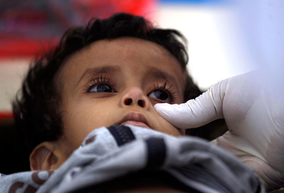 Yemen ‘facing worst cholera outbreak in the world’, health organizations say