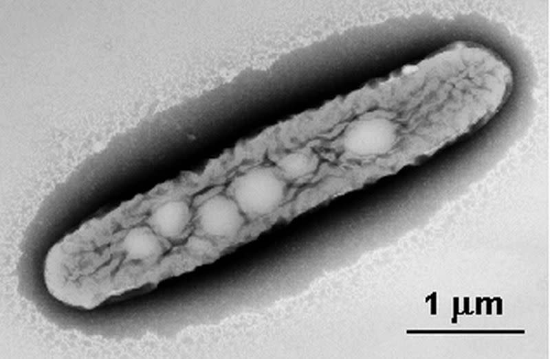 <i>Polaromonas vacuolata</i> criatura capaz de sobrevivir a temperaturas bajo cero. (Crédito imagen: genome.jigi.doe.gov).
