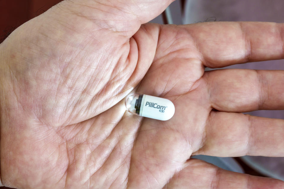 PillCam. (Foto: Jeffrey Greenberg/Education Images/Universal Images Group via Getty Images)