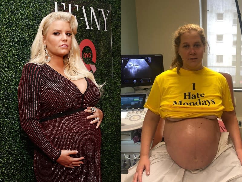 Jessica Simpson, left, and Amy Schumer, right, both in the late stages of pregnancy. (Photos: Getty/Instagram)