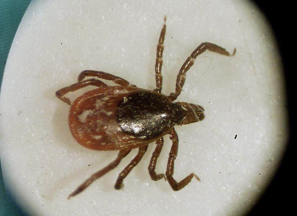 A deer tick under a microscope in the entomology lab at the University of Rhode Island.