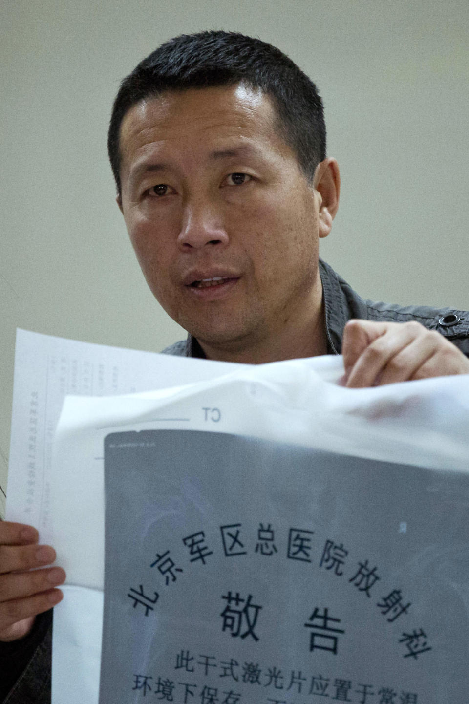 In this April 9, 2014 photo, lawyer Tang Jitian holds his X-ray photo as he waits to see a doctor about his back pains at a hospital in Beijing. Tang is among a group of four Chinese rights lawyers who allege they were tortured by police after being rounded up in late March outside a detention center in a farming community on the northeastern edge of China. (AP Photo/Alexander F. Yuan)