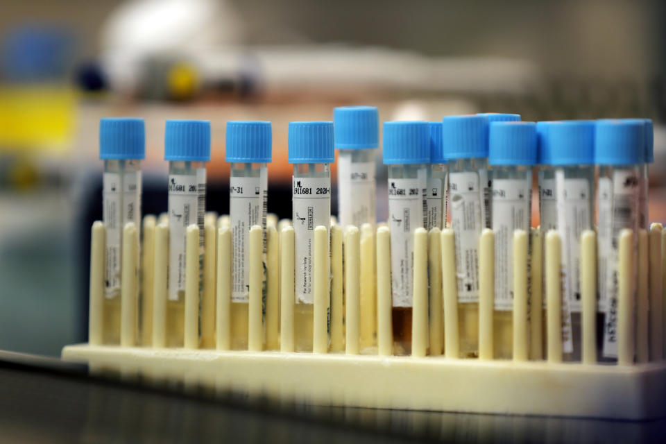 FILE - In this April 2, 2020 file photo, vials with samples taken for the new coronavirus are seen before they are prepared for RNA testing at the molecular pathology lab at Tulane University School of Medicine in New Orleans. Where political divides marred early recovery efforts after Hurricane Katrina in 2005, Louisiana is showing rare political unity in the fight against the new coronavirus. (AP Photo/Gerald Herbert, File)