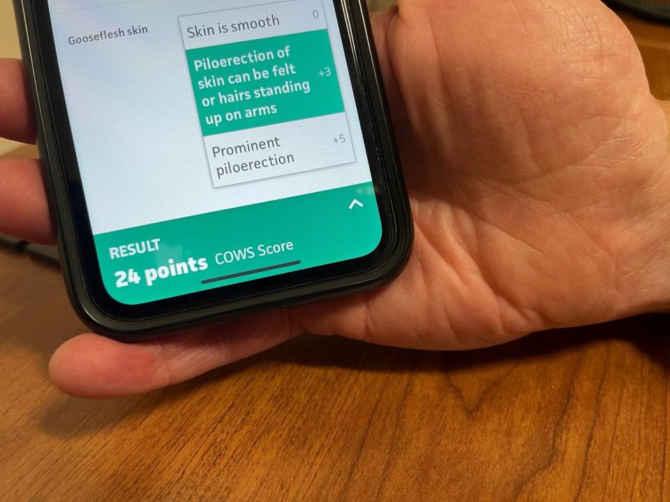 Dr. Daniel Wolfson explains how an app used to determine the severity of a patient's withdrawal symptoms works, as seen on June 9, 2023.