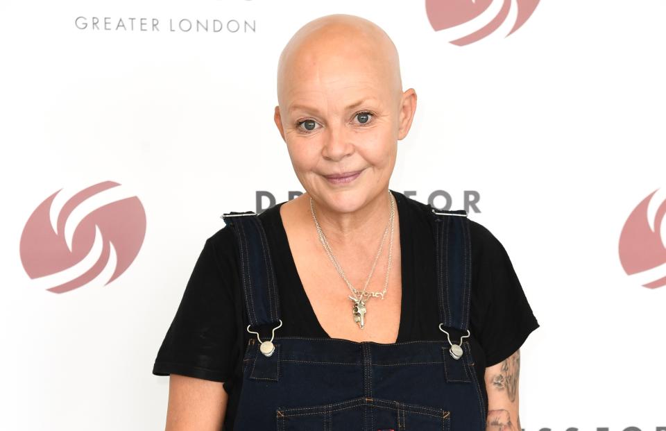 Gail Porter claims she was punched outside her home. (Getty Images)