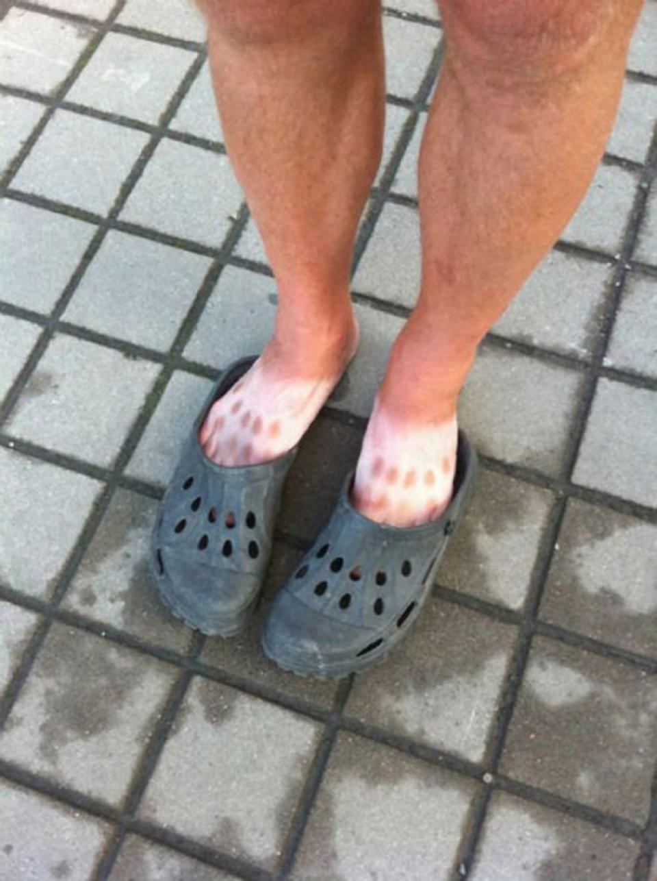 We’re not judging anyone for wearing Crocs but…