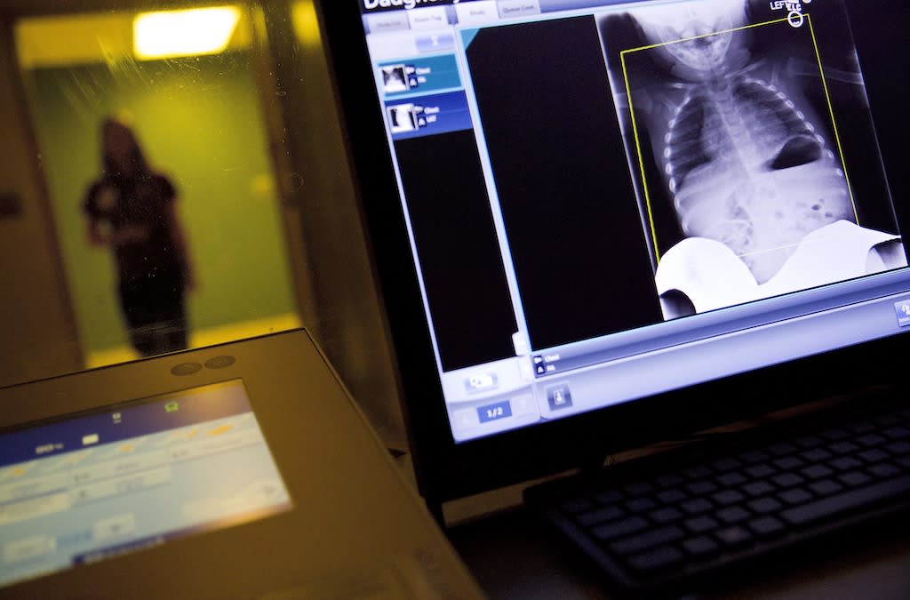 A chest X-ray at a medical center.