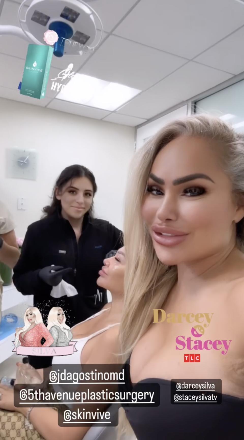 ‘90 Day Fiance’ Alums Darcey and Stacey Silva Reveals Latest Plastic Surgery Procedure- ‘Darcey Glow’