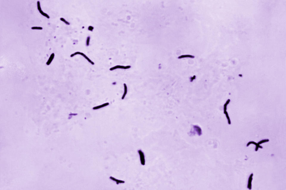 This 1966 microscope photo provided by the U.S. Centers for Disease Control and Prevention shows Mycobacterium tuberculosis bacilli, the organism responsible for causing the disease tuberculosis. The number of U.S. tuberculosis cases in 2023 were the highest in a decade, according to a report released by the CDC on Thursday, March 28, 2024. (Elizabeth S. Mingioli/CDC via AP)