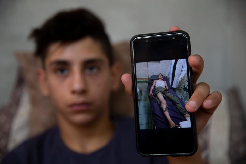 Palestinian youth Tareq Zubeidi, 15, shows an image of his wounds at his house in the West Bank village of Silat ad-Dhahr on Aug. 31, 2021. Zubeidi says he was abducted and beaten by a group of Israeli settlers after they found him and his friends eating snacks near an evacuated hilltop settlement in the occupied West Bank.