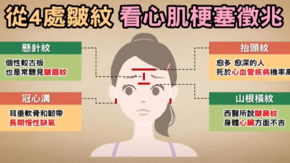 臉上4處皺紋恐是心血管疾病警訊。（圖／翻攝自健康2.0 YouTube）