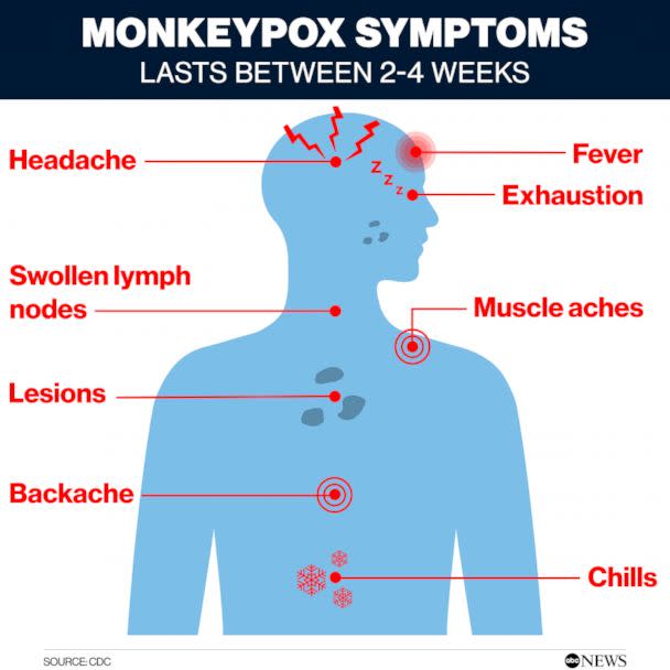 PHOTO: Monkeypox symptoms (CDC)