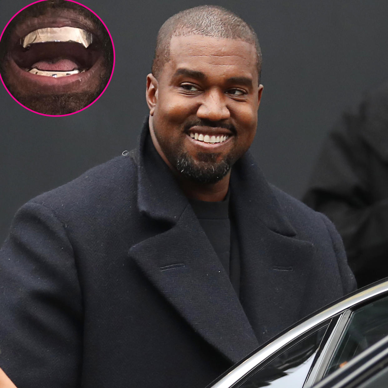 Kanye West Shows Off $850,000 Titanium Grill Inspired by James Bond Villain