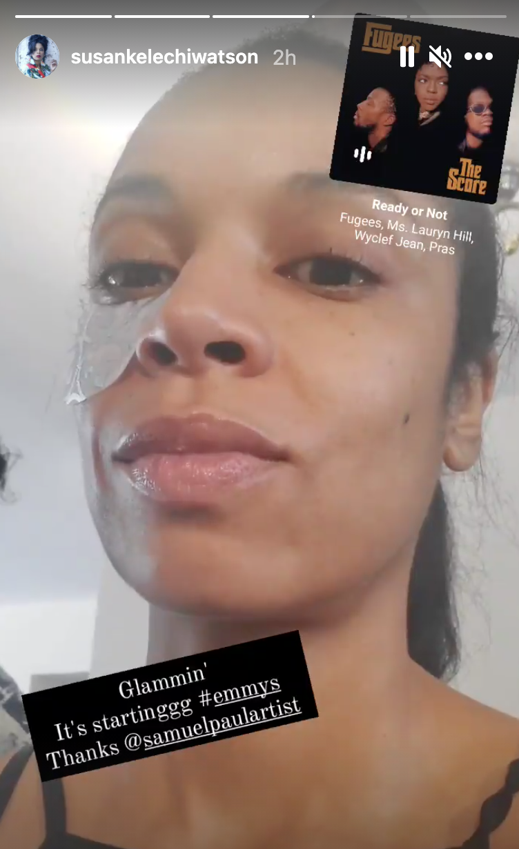 Susan Kelechi Watson as she has eye pads under her eyes