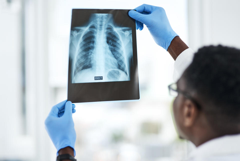 파란 장갑을 한 아프리카계 미국인 기사가 인간의 흉부의 X선 사진을 내걸고 있다.