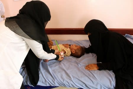 Nurse measures malnourished Muath Ali Muhammad at a health center in Aslam district of the northwestern province of Hajja