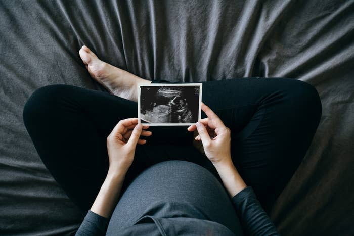 A pregnant woman holding a sonogram