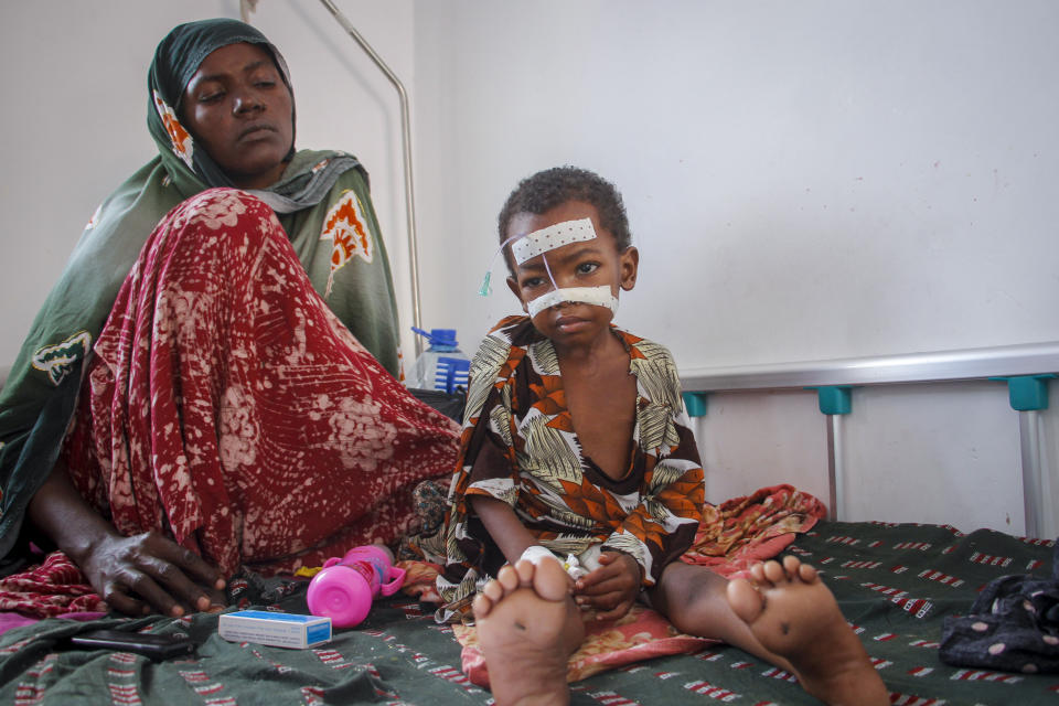 Malnourished Kalson Hussein, 4, sits next to her mother Isho Shukria, 35, at the Martini hospital where she is being treated in Mogadishu, Somalia Saturday, Sept. 3, 2022. Millions of people in the Horn of Africa region are going hungry because of drought, and thousands have died, with Somalia especially hard hit because it sourced at least 90 percent of its grain from Ukraine and Russia before Russia invaded Ukraine. (AP Photo/Farah Abdi Warsameh)