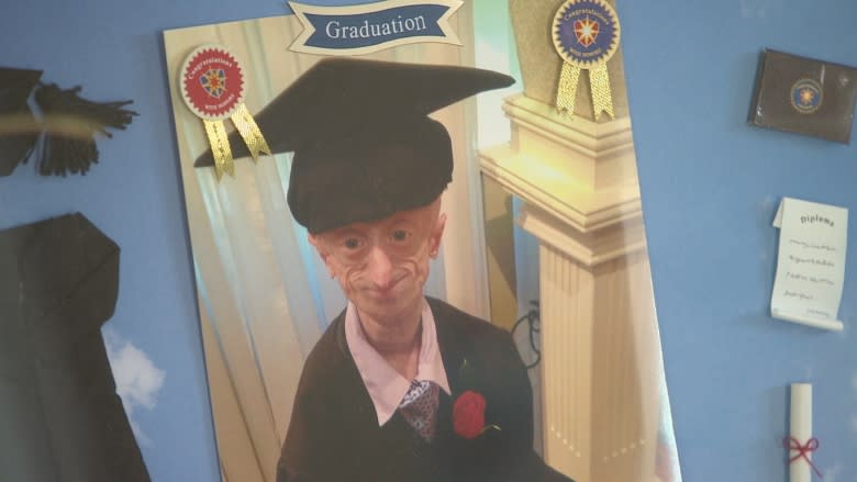 How Devin Scullion, Hamilton man with rare rapid aging disorder, is being remembered