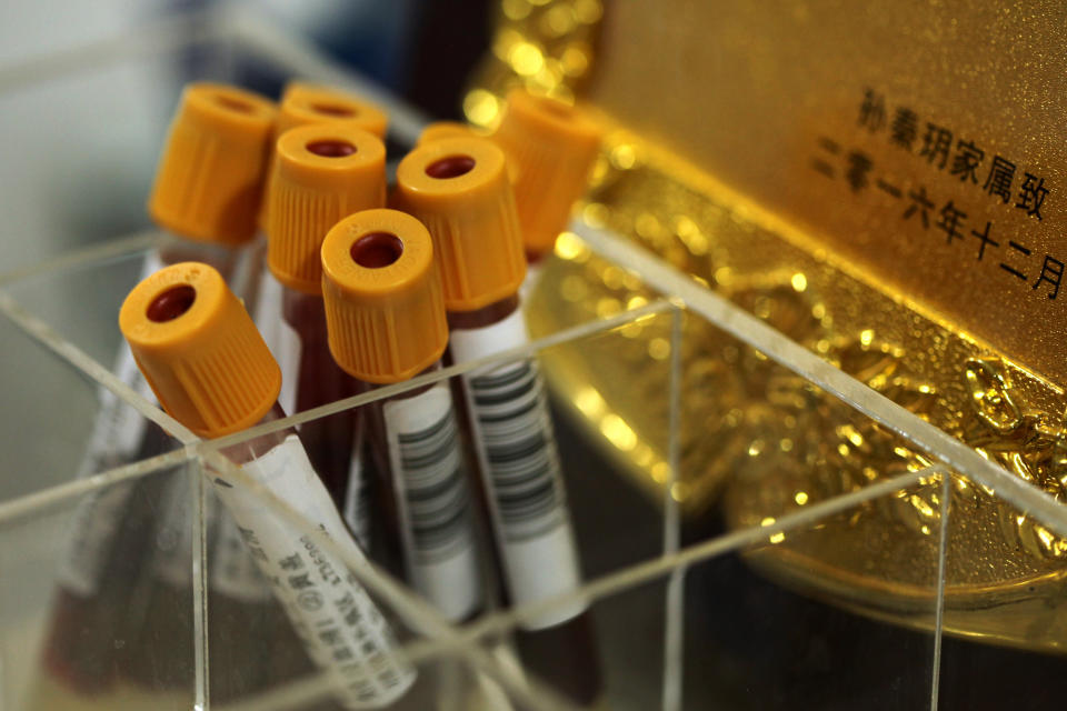 Sangre de pacientes en un hospital de Shanghai, China.  Foto: AP / Erika Kinetz.