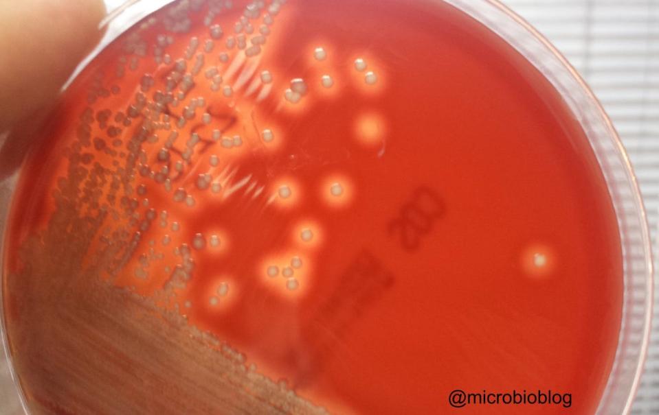 Beta-hemólisis sobre una placa de Agar sangre: obsérvese el halo de hemólisis alrededor de las colonias bacterianas. @microbioblog