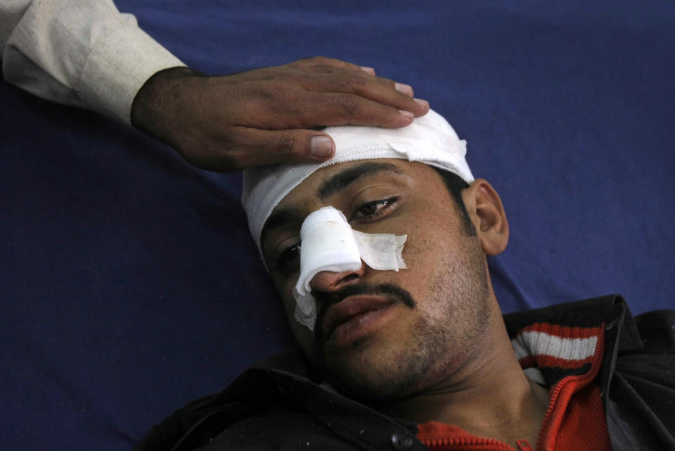 FILE - In this March 1, 2014 file photo, a Pakistani man, who was injured in a bomb blast near Peshawar, Pakistan, is comforted by a relative while laying in a hospital's bed receiving treatment. Pakistan has gone from thousands of terrorist attacks a year to a record low of less than 250 last year, according to two separate Pakistan-based organizations tracking militant activity. (AP Photo/Muhammad Sajjad,file)