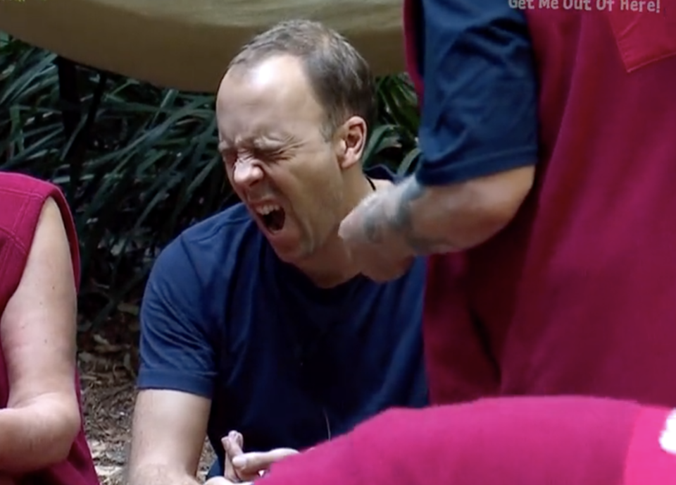 Matt Hancock was stung by a scorpion on I'm A Celebrity (ITV)