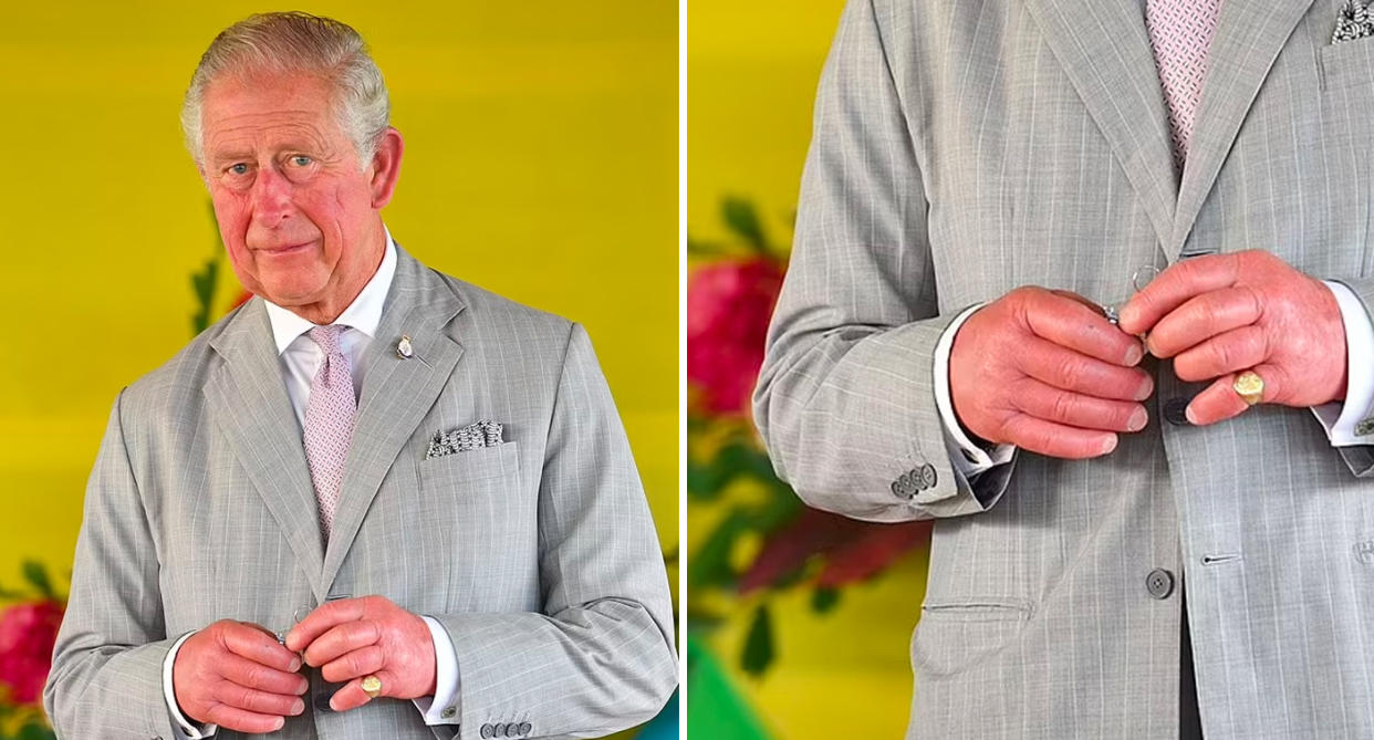 An image of King Charles' swollen fingers during a trip to the Solomon Islands in 2019. Source: Getty