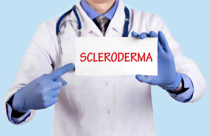 esclerodermia