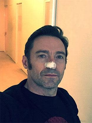 Hugh Jackman's cancer returns