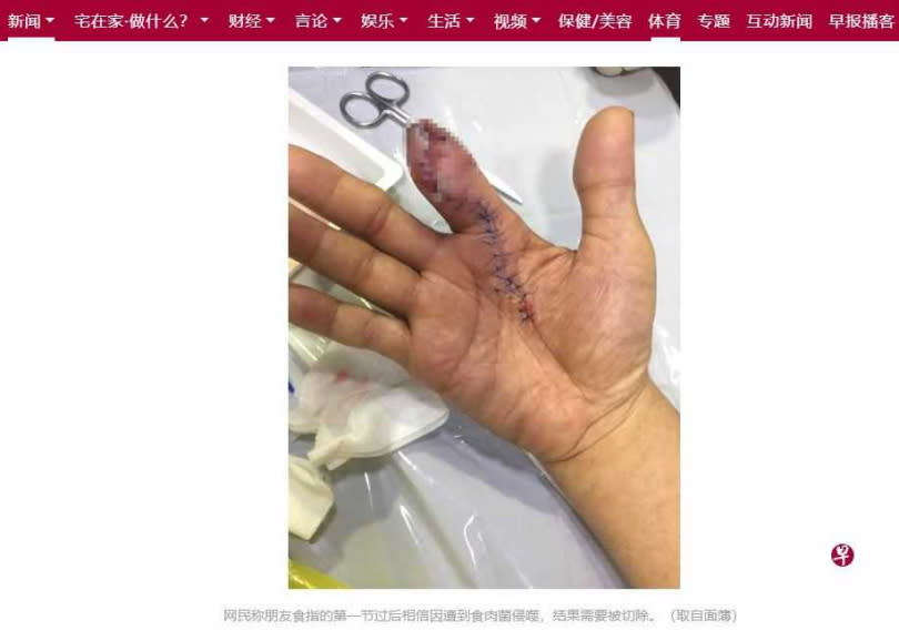 新加坡男子，因洗蝦不慎被尖銳蝦殼刺傷，發燒送醫一度住進加護病房，手指甚至還因此截肢。（圖／新加坡聯合早報）