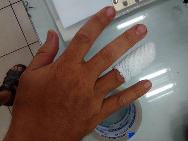 泰山分駐所所長張金全手指被咬傷。（警方提供）