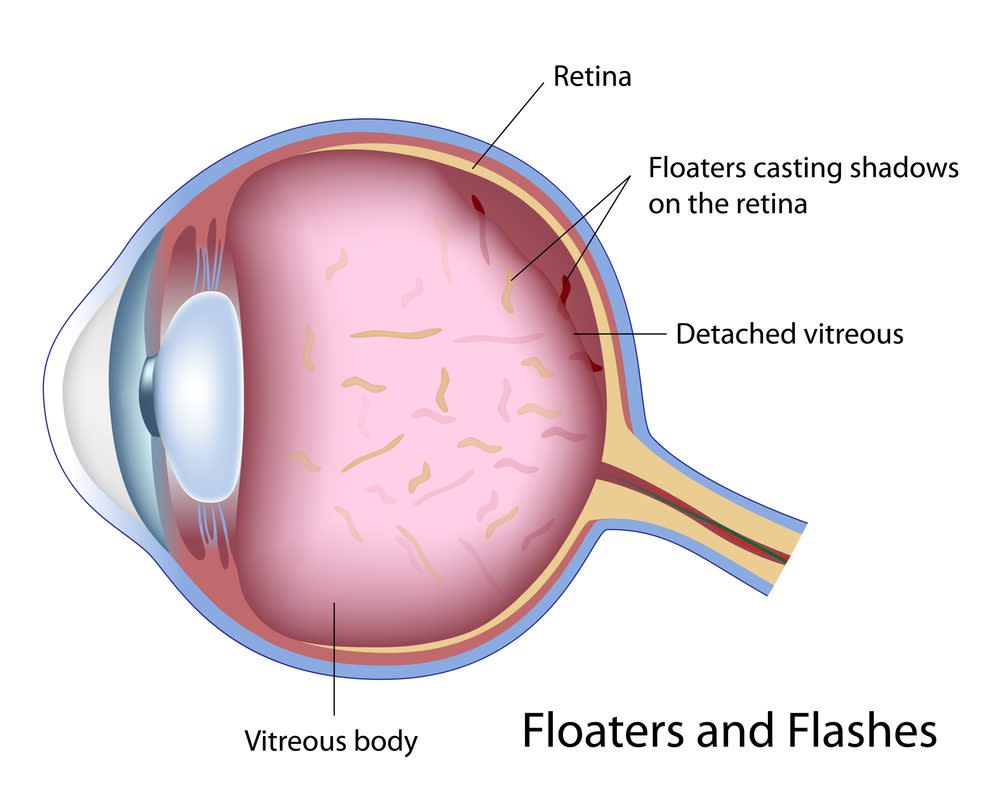 A drawing of the inside of an eye. 