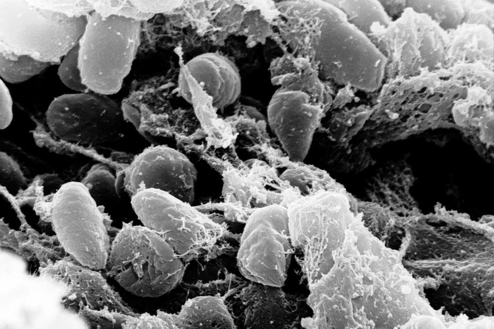 Yersinia pestis bacteria (NIAID / Universal Images Group via Getty Images)