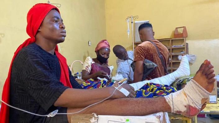 An injured woman in hospital with leg raised