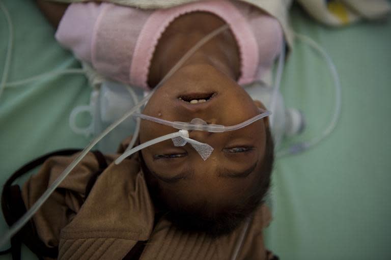Shahira Bibi, a severely malnourished Rohingya girl from Myanmar lies unconscious at the hospital in Langsa in Aceh province